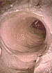 View up from the bottom of a pothole